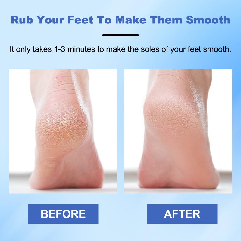 EOIRULA Veinsgrain Foot File  Nano Glass Foot File  Hard Skin Remover Nano-Glass Foot File  Veins Grain Foot File  Professional Foot Care Tools  Pedicure Tool for Smooth Feet (Blue) - Image 3